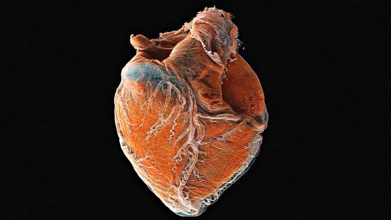 Новый метод медицинской визуализации поможет эффективнее лечить болезни сердца