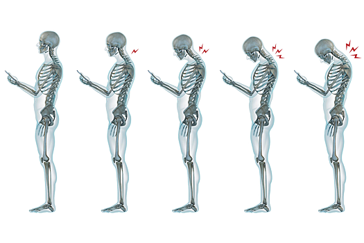 Утомление мышц шеи может навредить позвоночнику, доказали ученые