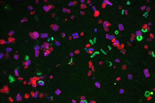 Найдены бактерии, поедающие токсичные «вечные химикаты»