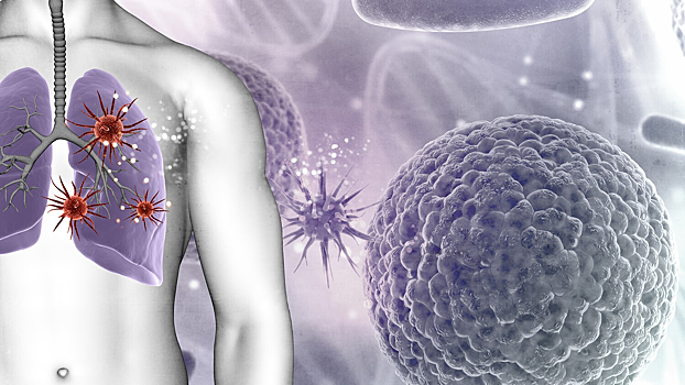 Рак легких все чаще поражает никогда не куривших людей