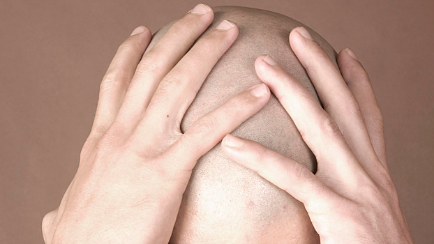 Ученые разработали средство, которое вернет волосы после облысения