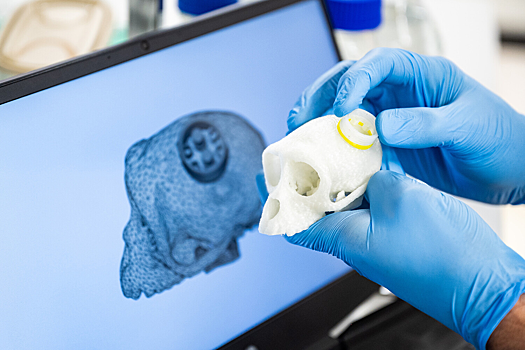 В России создали врастающее в череп крепление электродов