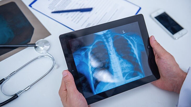 В России создали сервис для диагностики коронавирусной пневмонии