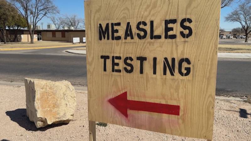 В США впервые за 10 лет зарегистрировали смерть от кори