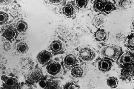 Ученые нашли причину необъяснимых обострений герпеса