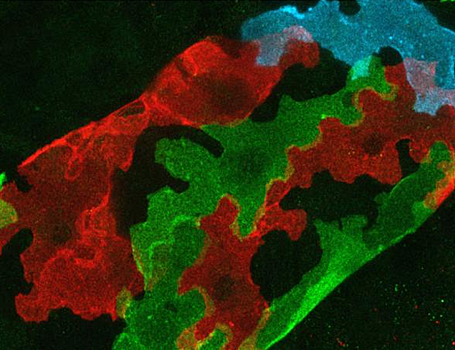 Ученые выяснили, как мельчайшие лимфатические сосуды сохраняют целостность