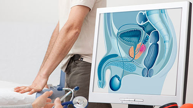 Найден способ быстрее диагностировать рак простаты
