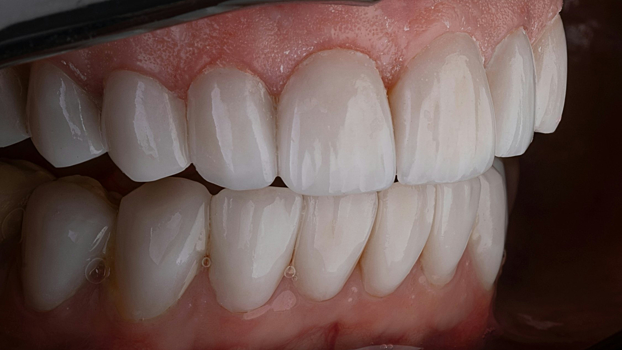 Ученые приблизились к повторному выращиванию зубов у людей