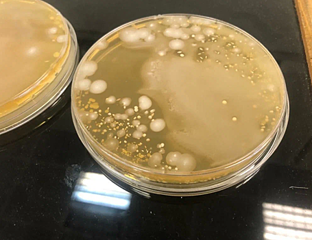 Ученые выделили из кишечника фазанов бактерии для создания пробиотиков