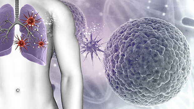 Разработан алгоритм выявления рака по врачебным записям