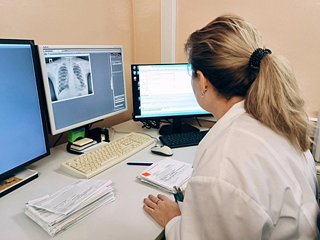 Кировские рентгенологи обучают ИИ анализировать флюорографии