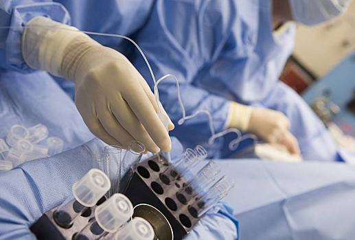 Победа над бесплодием: мужчине впервые пересадили чужие сперматозоиды