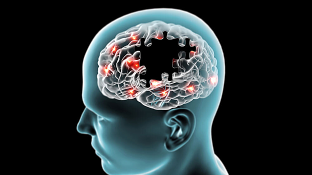 Где живет логика: найден участок мозга, отвечающий за рассуждения