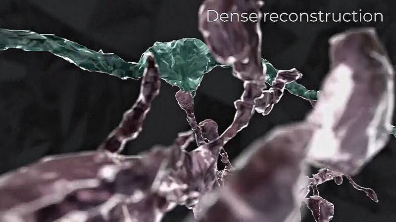 Как исследование мозга мыши поможет лечить болезнь Альцгеймера