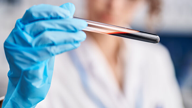 Совершен прорыв в производстве клеток крови