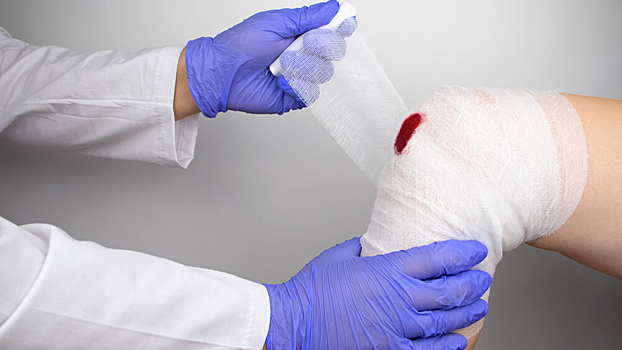 Ученые сравнили скорость заживления ран у людей и животных