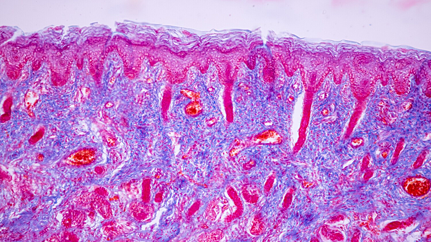 Новая генная терапия вылечила детей от редкого иммунодефицита
