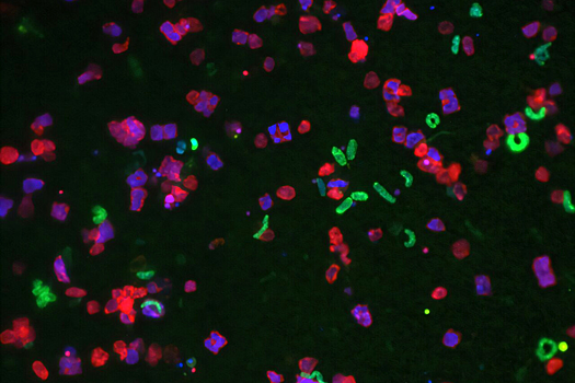 Кишечные бактерии могут играть роль маркеров рака, выяснили ученые