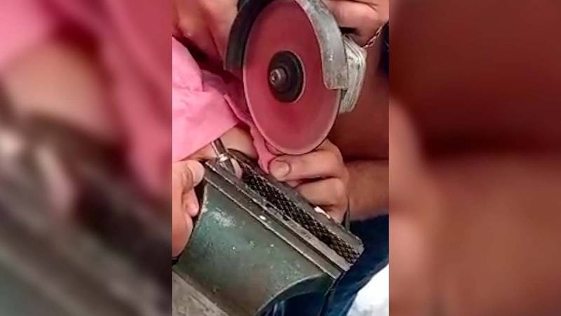 Жительница Крымска чуть не лишилась пальца из-за необычного кольца