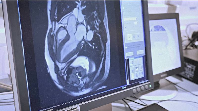 Британские учёные просканировали 100 тысяч тел для медицины