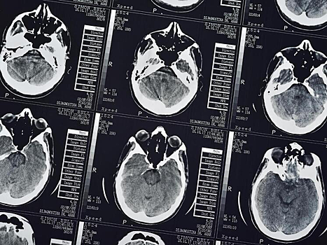 Ученые выяснили, как мозг выбирает место для включения «обезболивания»