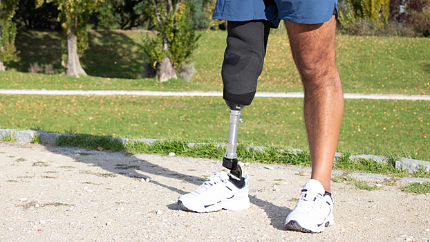 В России впервые провели операцию по вживлению протеза в кость