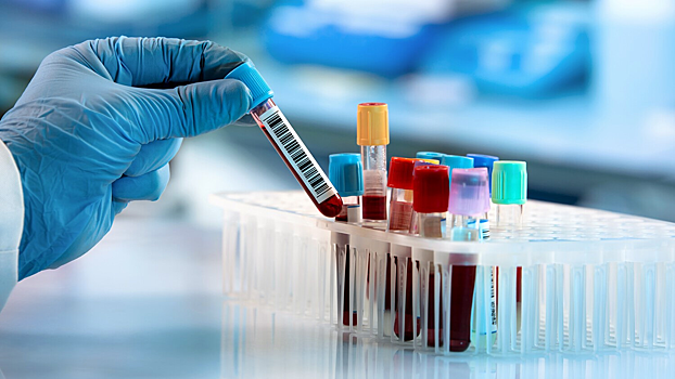 В крови переболевших COVID-19 нашли необычные изменения