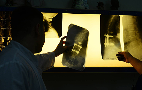 Создана программа для диагностики возрастных изменений позвоночника