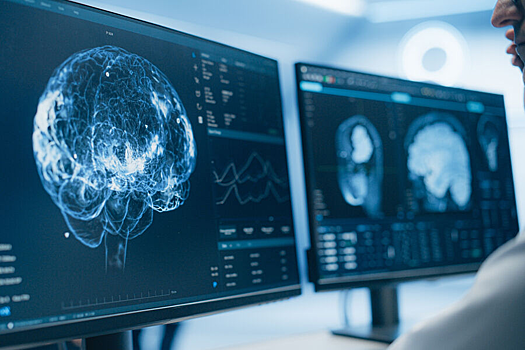 Найден способ остановить ранние изменения в мозге при болезни Альцгеймера