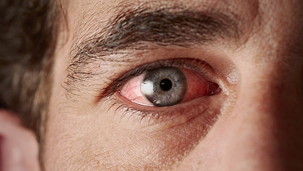 Вещества из растений могут замедлить потерю зрения при диабете