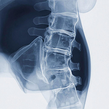 Ученые использовали жировую ткань для восстановления костей