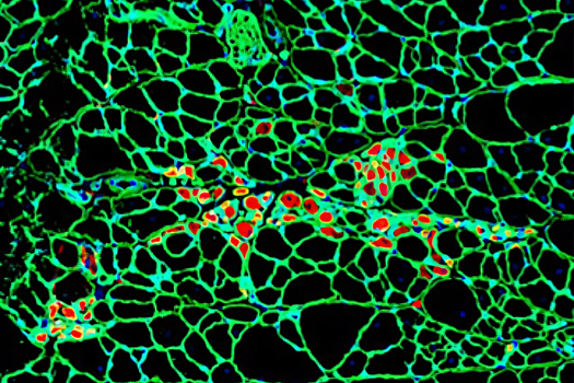 Ученые раскрыли физический принцип, стоящий за развитием рака