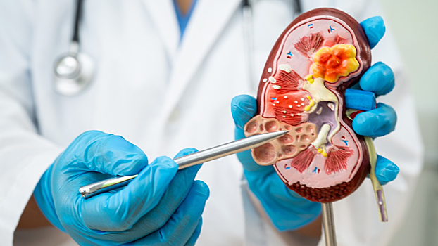 Ученые выяснили, что ускоряет развитие болезни Альцгеймера