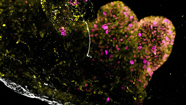 Выращен первый в мире полноценный мини-желудок