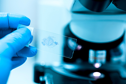 Найден способ подавить «биологический шум», из-за которого возвращается рак