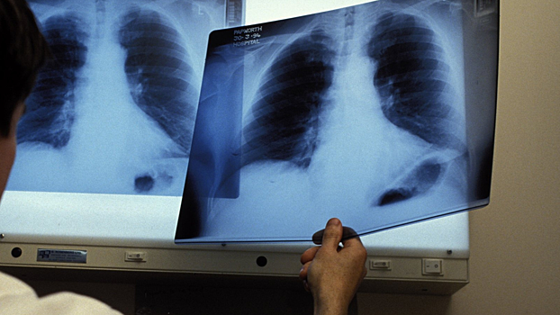 Ученые создали дышащее человеческое «легкое на чипе»