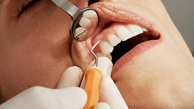 Какая бактерия в полости рта может повышать риск рака груди