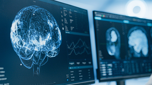 Выявлена область мозга, связанная с потерей физической силы