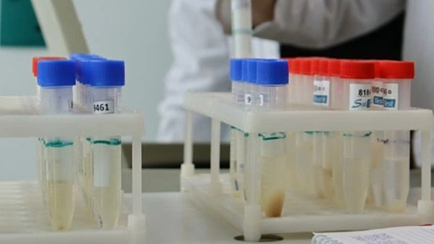 Разработана экспресс-диагностика рака по слюне пациента