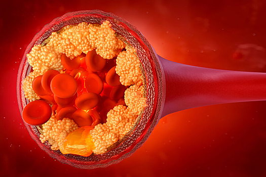 Развеян популярный миф о побочных эффектах статинов
