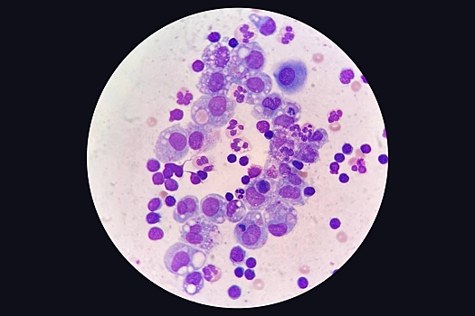 В России научились запускать восстановление тканей