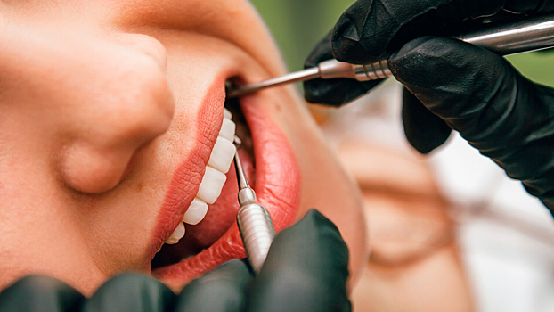 В России разработали новый биоматериал для зубных имплантов