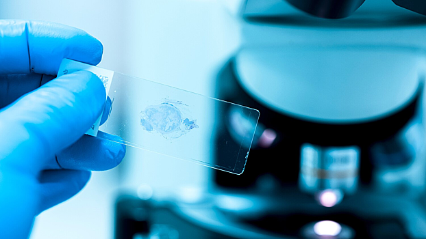 Ученые выяснили, что ускоряет лечение рака