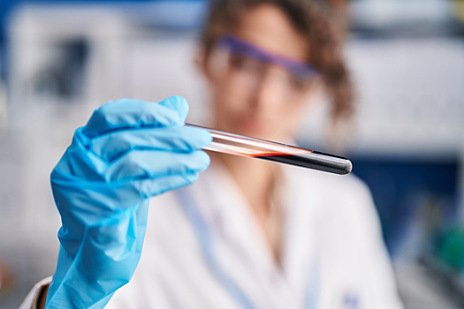 В крови долгожителей обнаружили 37 «белков долголетия»