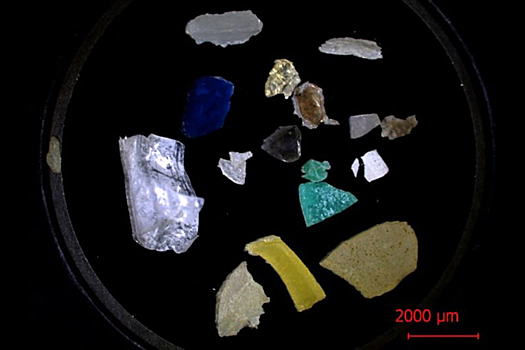 Выявлен неочевидный фактор риска развития болезни Паркинсона