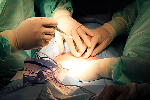 Найден необычный способ ускорить заживление ран после операций