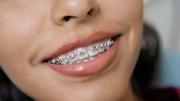 ИИ оказался точнее врачей в оценке снимков челюсти