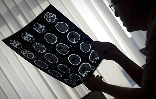 Выявлен регион мозга, связанный с развитием алкоголизма