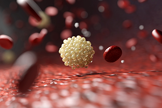 Стало известно, как холестерин стимулирует рост агрессивного рака