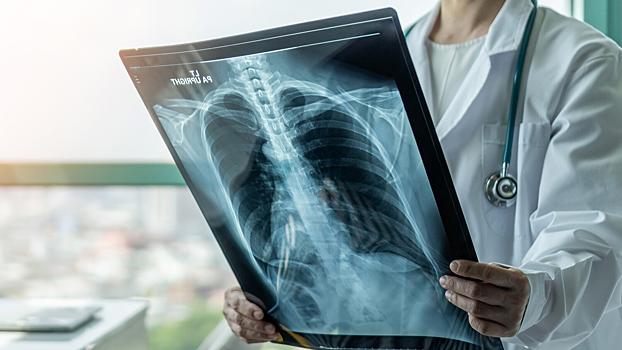 Разработан ИИ-модуль для планирования операций на легких